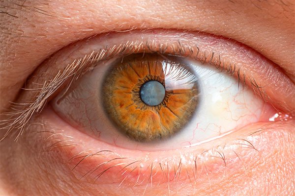 Como é feita a cirurgia de catarata?